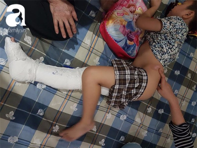 Học sinh lớp 2 bị gãy chân, gia đình nói do xe ô tô đâm trong sân trường, nhà trường nói tự ngã - Ảnh 1.