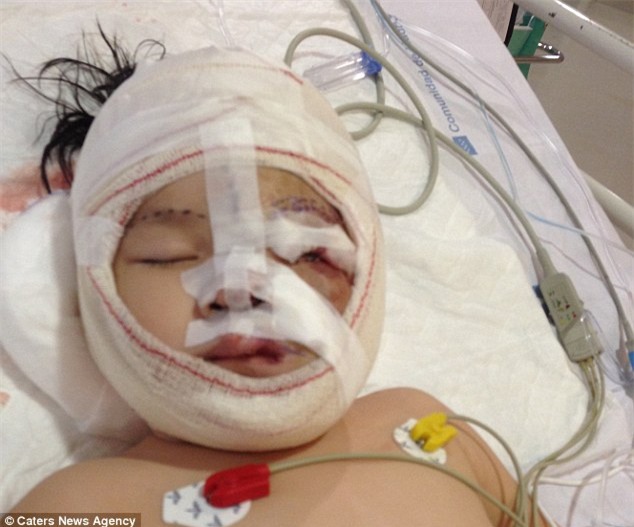 Bé gái 5 tuổi mang khối u che hết nửa gương mặt bất ngờ được một người xa lạ cứu sống - Ảnh 2.