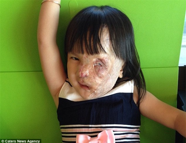 Bé gái 5 tuổi mang khối u che hết nửa gương mặt bất ngờ được một người xa lạ cứu sống - Ảnh 5.