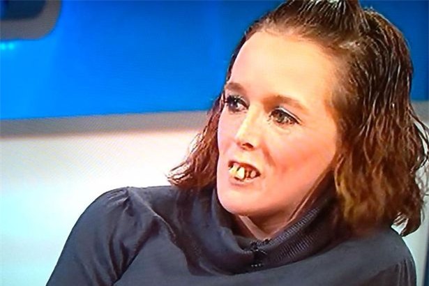 Bạn có nhớ quý cô răng hô năm nào? Gương mặt hiện tại của cô ấy đã xinh đẹp hơn rất nhiều - Ảnh 1.