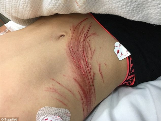 Cảnh báo: Nam thanh niên suýt đứt cổ vì đi xe máy, đeo tai nghe iPhone - Ảnh 3.