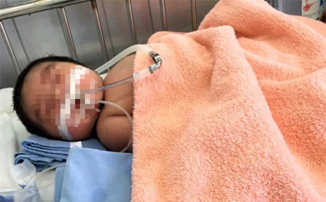 Cha mẹ không hiểu biết, trẻ sơ sinh mắc bệnh này có thể tử vong