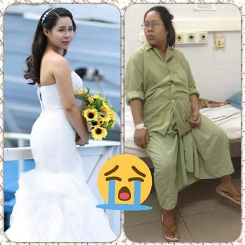 Đi ngược trào lưu sống ảo, chị em tự tin khoe ảnh xấu không thể tả khi mang bầu - Ảnh 1.