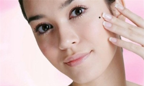 May mắn và sung túc sẽ đến nếu bạn sở hữu nốt ruồi ở 12 vị trí này - Ảnh 1.