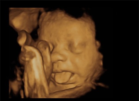 Hình ảnh Những biểu hiện chết cười của thai nhi trong bụng mẹ số 6