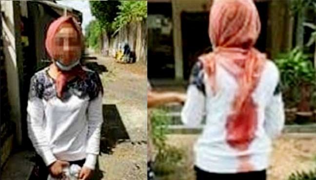 Nữ giúp việc 19 tuổi người Indonesia bị bà chủ Malaysia bạo hành dã man - Ảnh 2.