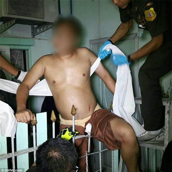 Trèo lên lan can phơi quần áo, một thanh niên bị hàng rào sắt đâm trúng chỗ hiểm - Ảnh 1.