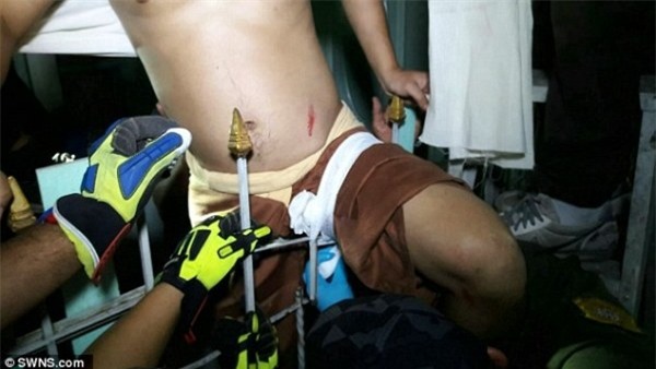 Trèo lên lan can phơi quần áo, một thanh niên bị hàng rào sắt đâm trúng chỗ hiểm - Ảnh 2.