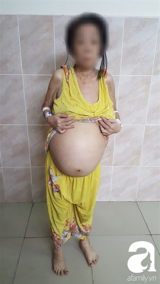 Cứu sống một phụ nữ mang khối u trong tử cung nặng đến…12kg - Ảnh 1.