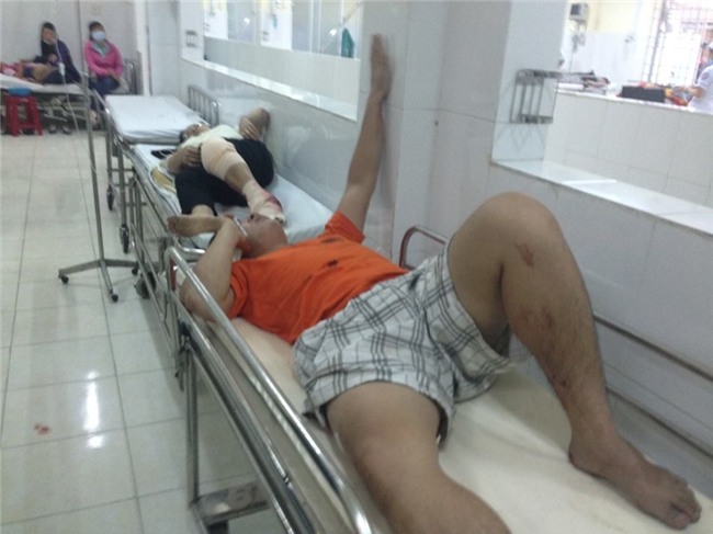 lòi kẻ con tin bị kẻ nghi ngáo dá dam lien tiép ỏ nha trang hinh anh 2
