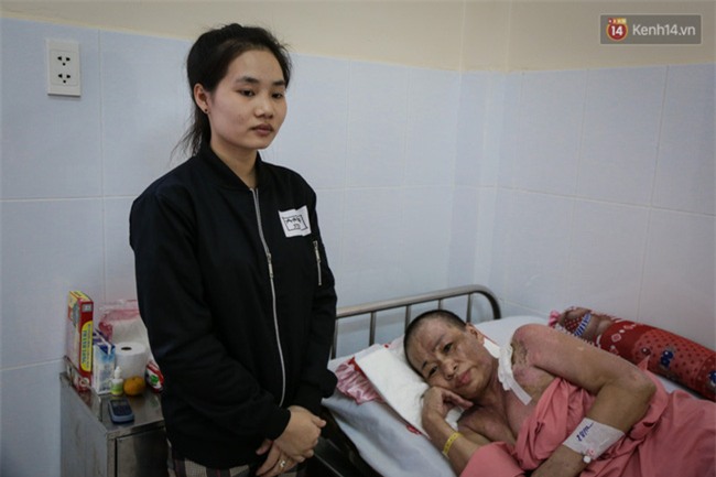 Không móc cống nghẹt, người phụ nữ ở Sài Gòn bị tạt nồi thịt sôi vào người gây bỏng nặng - Ảnh 3.