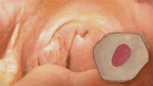 Miệng bốc mùi là do căn bệnh nguy hiểm này - Ảnh 1.