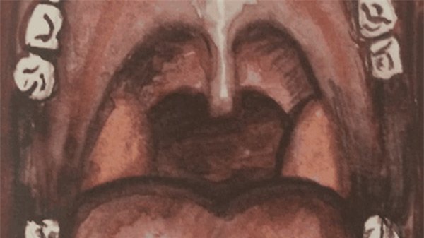 Miệng bốc mùi là do căn bệnh nguy hiểm này - Ảnh 2.