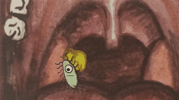 Miệng bốc mùi là do căn bệnh nguy hiểm này - Ảnh 3.