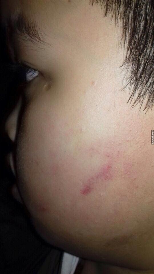 Hà Nội: Nghi học sinh lớp 4 bị cô giáo cho 43 bạn cùng lớp tát vào mặt? - Ảnh 1.