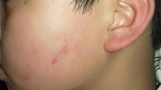 Cô giáo cho hơn 40 học sinh tát bạn bị đình chỉ ít nhất một học kỳ