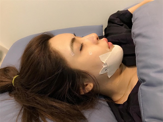 Cô nàng nghiện phẫu thuật thẩm mỹ tá hỏa vì 2 chiếc ốc vít nằm trong cằm độn - Ảnh 1.