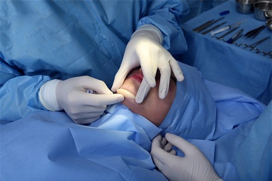 Cô nàng nghiện phẫu thuật thẩm mỹ tá hỏa vì 2 chiếc ốc vít nằm trong cằm độn - Ảnh 5.