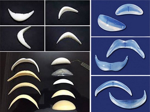 Cô nàng nghiện phẫu thuật thẩm mỹ tá hỏa vì 2 chiếc ốc vít nằm trong cằm độn - Ảnh 8.