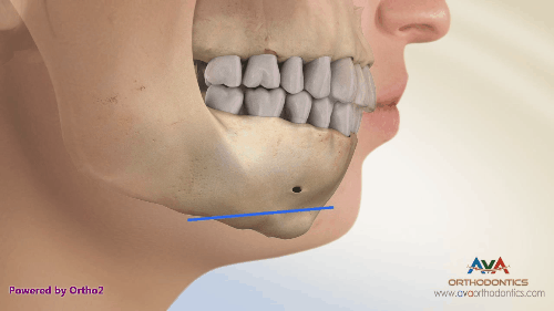 Cô nàng nghiện phẫu thuật thẩm mỹ tá hỏa vì 2 chiếc ốc vít nằm trong cằm độn - Ảnh 9.