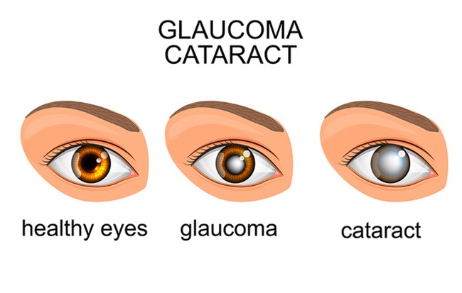 6 căn bệnh nguy hiểm âm thầm tấn công nên lúc phát hiện thì... quá muộn! - Ảnh 2.