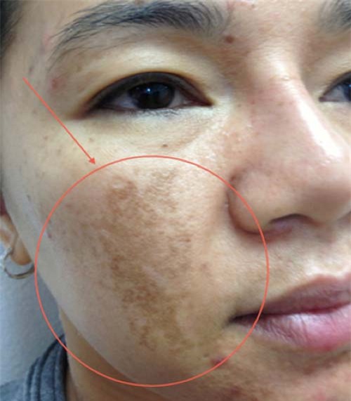chi can dung com nhu the nay nam, tan nhang cung dau den dau cung bi danh bai - 1