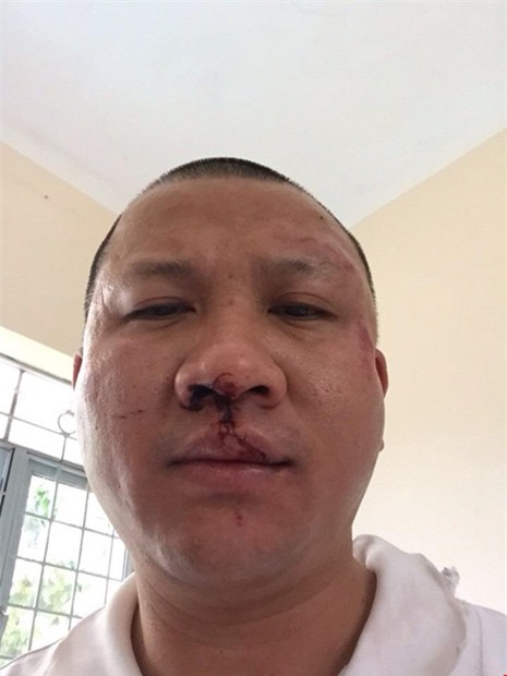 1 phụ nữ bị truy tố vì cướp của đại gia gần 1 tỉ đồng