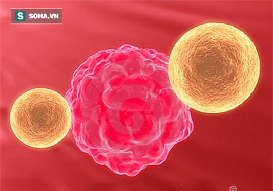 Thoát ung thư trực tràng di căn lên phổi sau 9 tháng điều trị: Hàng nghìn người hi vọng! - Ảnh 1.