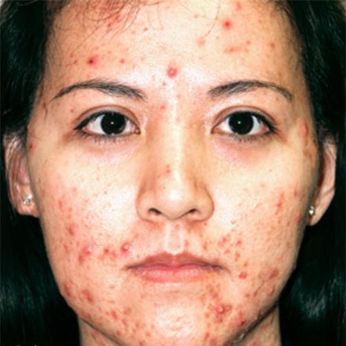 de co mat dep don tet, cac nang da mun hay xem xet ngay 3 cach duoi day - 1