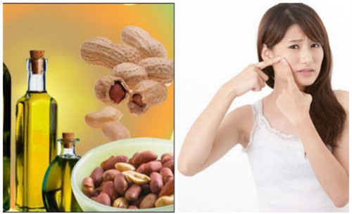 de co mat dep don tet, cac nang da mun hay xem xet ngay 3 cach duoi day - 2