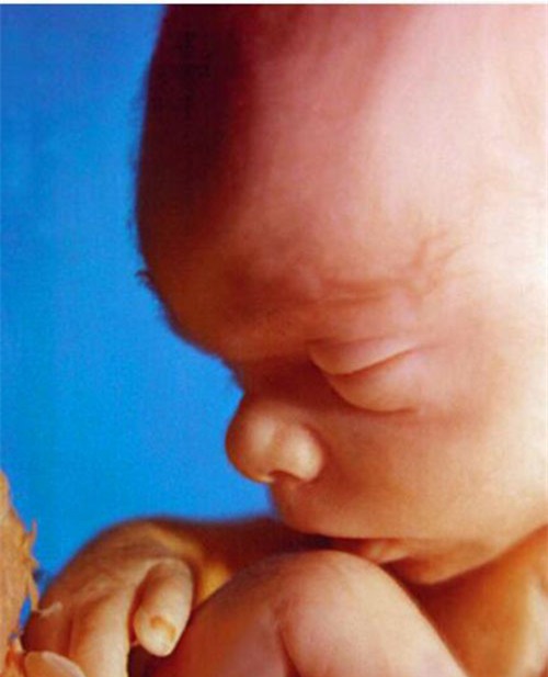 nhung buc anh sieu am ro tung centimet khien bac si cung phai giat minh - 1