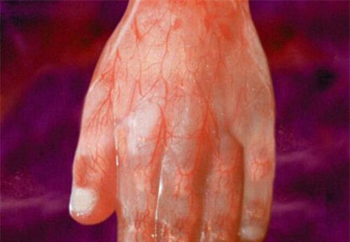 nhung buc anh sieu am ro tung centimet khien bac si cung phai giat minh - 3