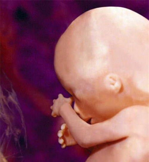 nhung buc anh sieu am ro tung centimet khien bac si cung phai giat minh - 4