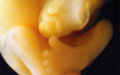 nhung buc anh sieu am ro tung centimet khien bac si cung phai giat minh - 5