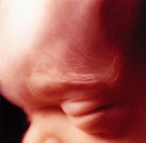 nhung buc anh sieu am ro tung centimet khien bac si cung phai giat minh - 6