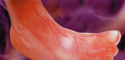 nhung buc anh sieu am ro tung centimet khien bac si cung phai giat minh - 8