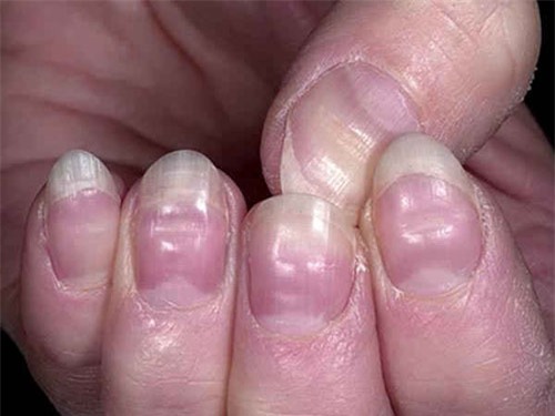 9 bo phan ban nhat cua co the, ban chac chan se khong ngo toi - 5