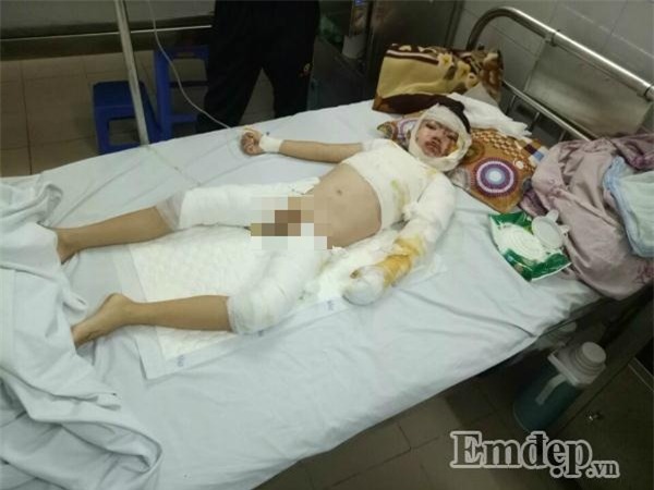 Phẫn nộ hai mẹ con nghi bị hất nước sôi trong lúc ngủ say ở Hà Nội