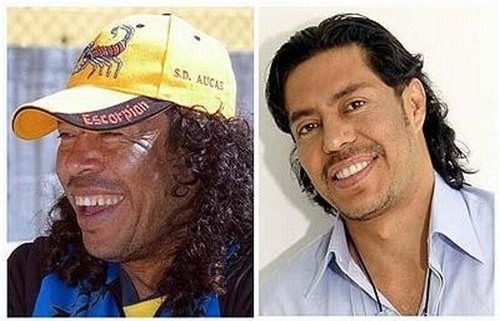 Ronaldo, Beckham và những ngôi sao bóng đá nhờ cậy vào dao kéo - Ảnh 1.