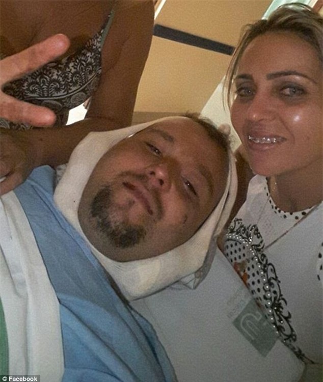 Ngư dân sống sót kỳ diệu dù bị thanh sắt xuyên qua đầu - Ảnh 2.