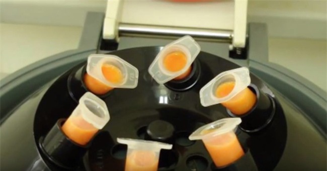 Cấy mỡ tự thân - Phương pháp làm đẹp 2 trong 1 đang hot nhất hiện nay - Ảnh 4.