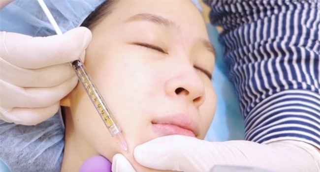 Cấy mỡ tự thân - Phương pháp làm đẹp 2 trong 1 đang hot nhất hiện nay - Ảnh 6.