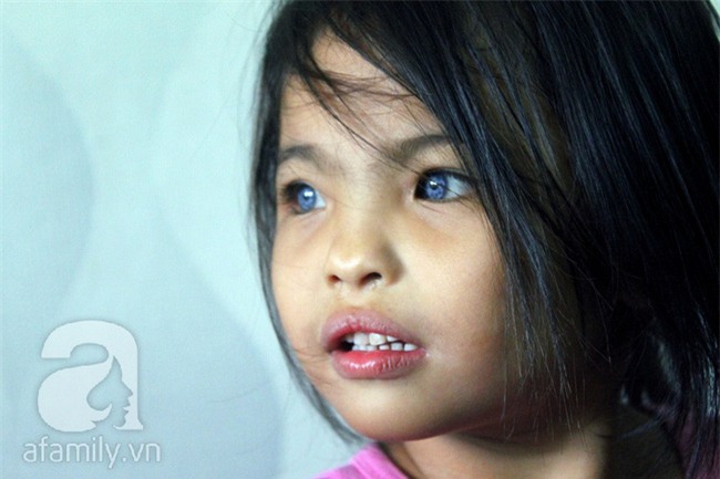 Hai em bé câm điếc có đôi mắt màu xanh bí ẩn ở Sài Gòn đã nghe được những thanh âm đầu tiên - Ảnh 11.