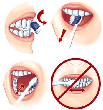 Tẩy trắng răng ai nên, ai không? - Ảnh 1.