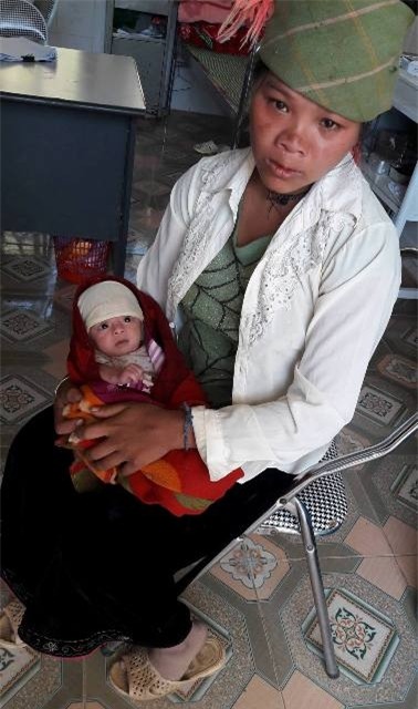 Đã gần 2 tháng tuổi nhưng cháu bé chỉ nặng hơn 2kg. Ảnh: C.T