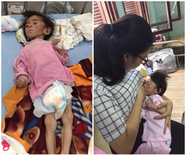 Cái Tết đầu tiên ấm áp nụ cười của em bé Lào Cai suy dinh dưỡng bên mẹ nuôi 9X - Ảnh 1.