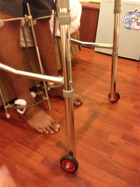 Chàng trai phẫu thuật kéo chân từ 1m67 lên 1m76: Vẫn cõng được người yêu như thường! - Ảnh 7.