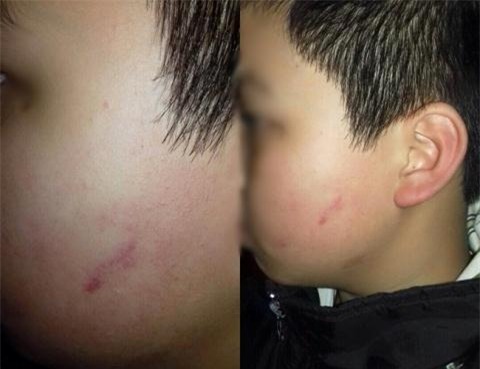 Kết quả hình ảnh cho cô giáo cho hs tát bạn