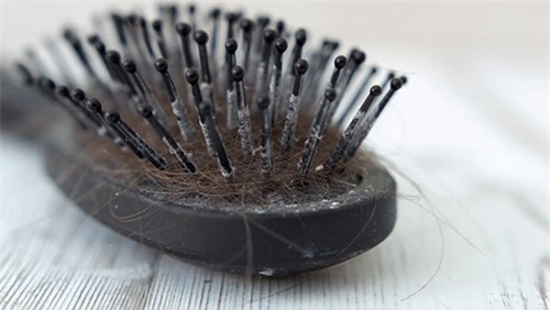 chuyen kinh khung gi se xay ra neu ban khong ve sinh luoc deu dan? - 3