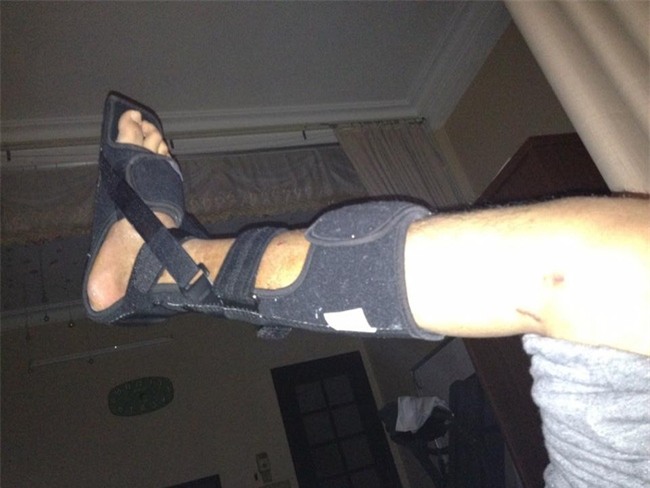 Nhật ký kéo dài chân từ 1m67 đến 1m76 (9 cm) của chàng trai Hà Nội - Ảnh 10.